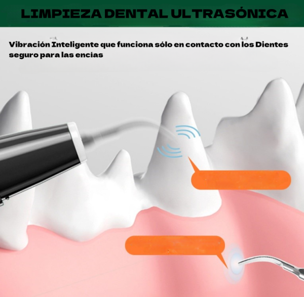 Limpiador Dental Ultrasónico - Imagen 4