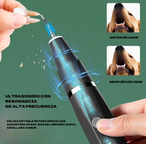 Limpiador Dental Ultrasónico - Imagen 3